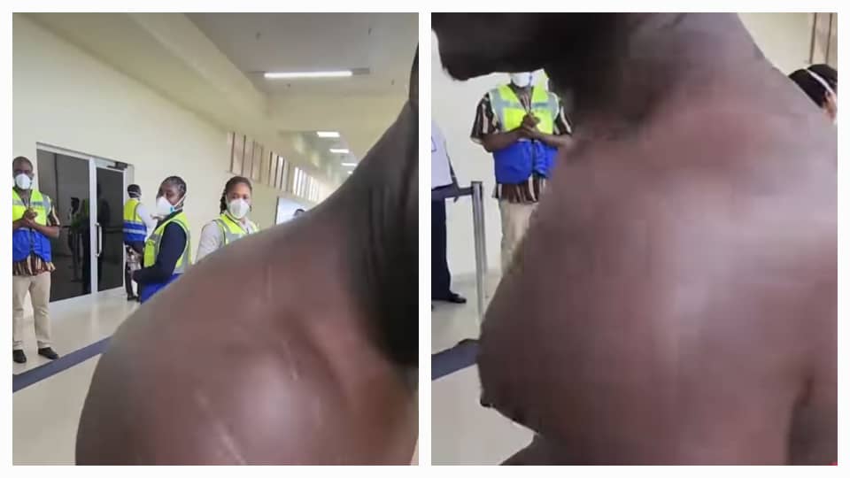 Evacuee shows injuries after xenophobic attacks in South Africa, praising Ghana’s rescue mission for bringing him and others home safely.